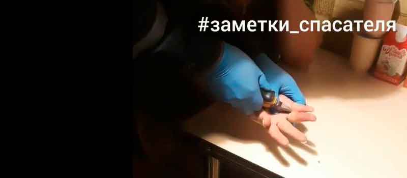 Спасатели избавили палец ковровчанки от тесного кольца